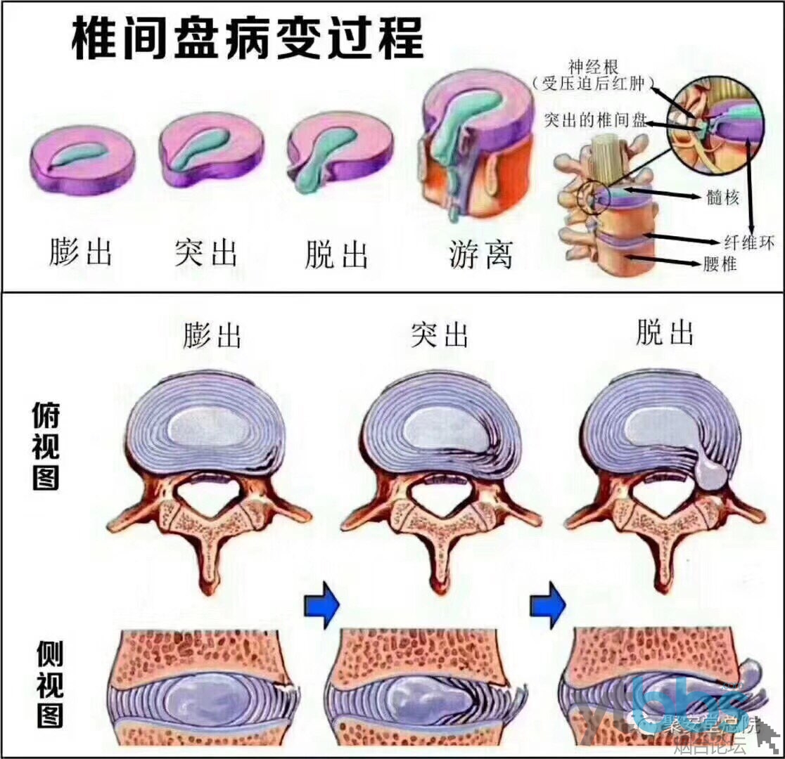 长春腰间盘治疗基金的设立与所在位置 长春腰间盘治疗基金在哪